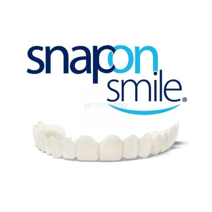 “ Snap-On Smile 〗 “ dýhy 〗